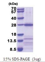 Neuronal acetylcholine receptor subunit alpha-3 (32-240, His-tag) Human Protein Neuronal acetylcholine receptor subunit alpha-3 (32-240, His-tag) Human Protein