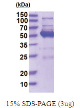 MAPK8 / JNK1 (1-427, His-tag) Human Protein