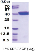 Maltose Binding Protein Tag / MBP-Tag (27-396) E.coli Protein ...