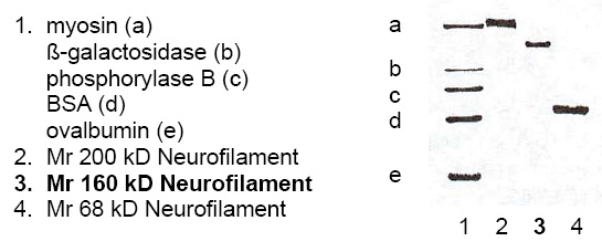 Lane 1 shows myosin (a), beta-galactosidase (b), phosphorylase B (c), BSA (d) and ovalbumin (e) as markers <br/>
Lane 2 shows Cat.No. BA1014/BA1014S Neurofilament H (200 kD)<br/>
Lane 3 shows Cat.No. BA1013/BA1013S Neurofilament M (160 kD)<br/>
Lane 4 shows Cat.No. BA1012/BA1012S Neurofilament L (68kDa)