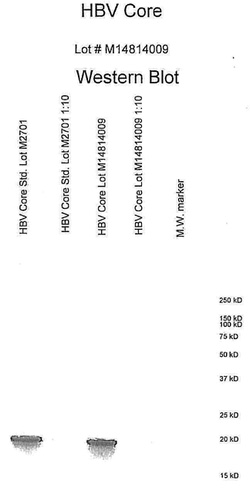 Hepatitis B Core Antigen / HBcAg Human Protein