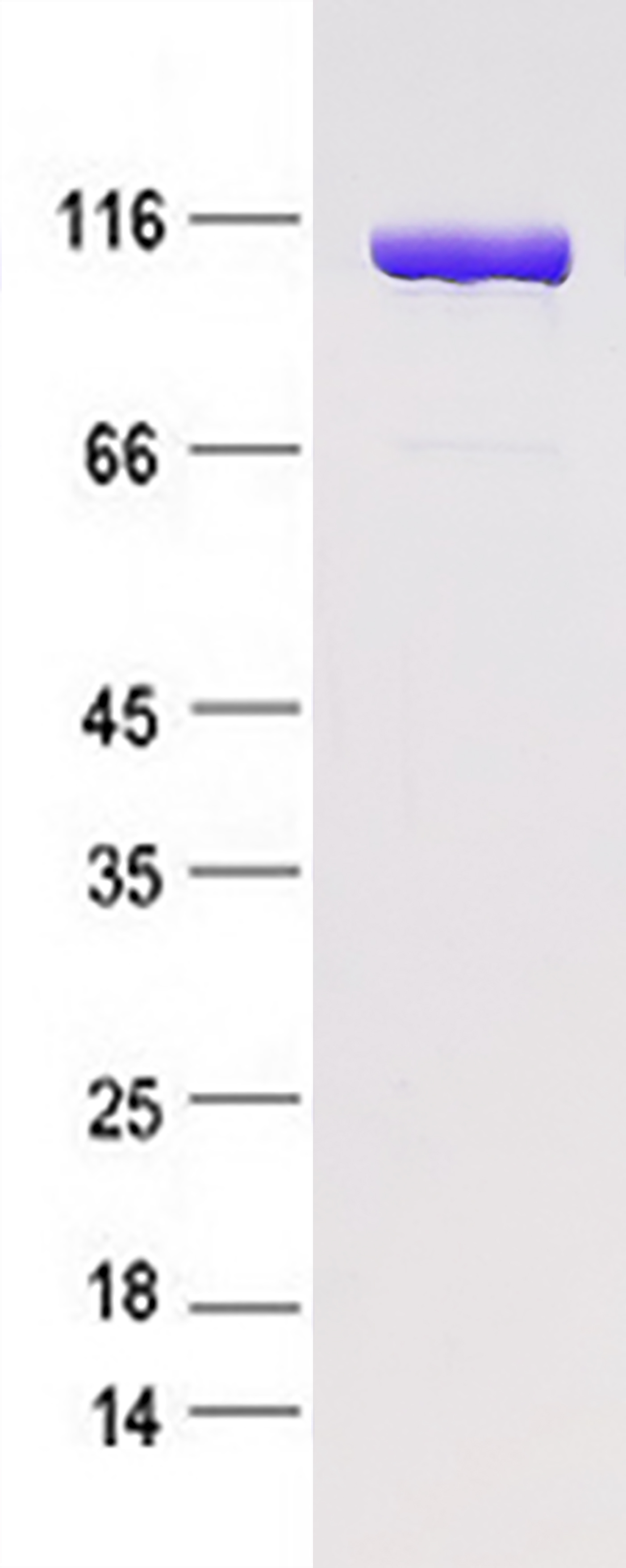 SND1 (NM_014390) Human Recombinant Protein