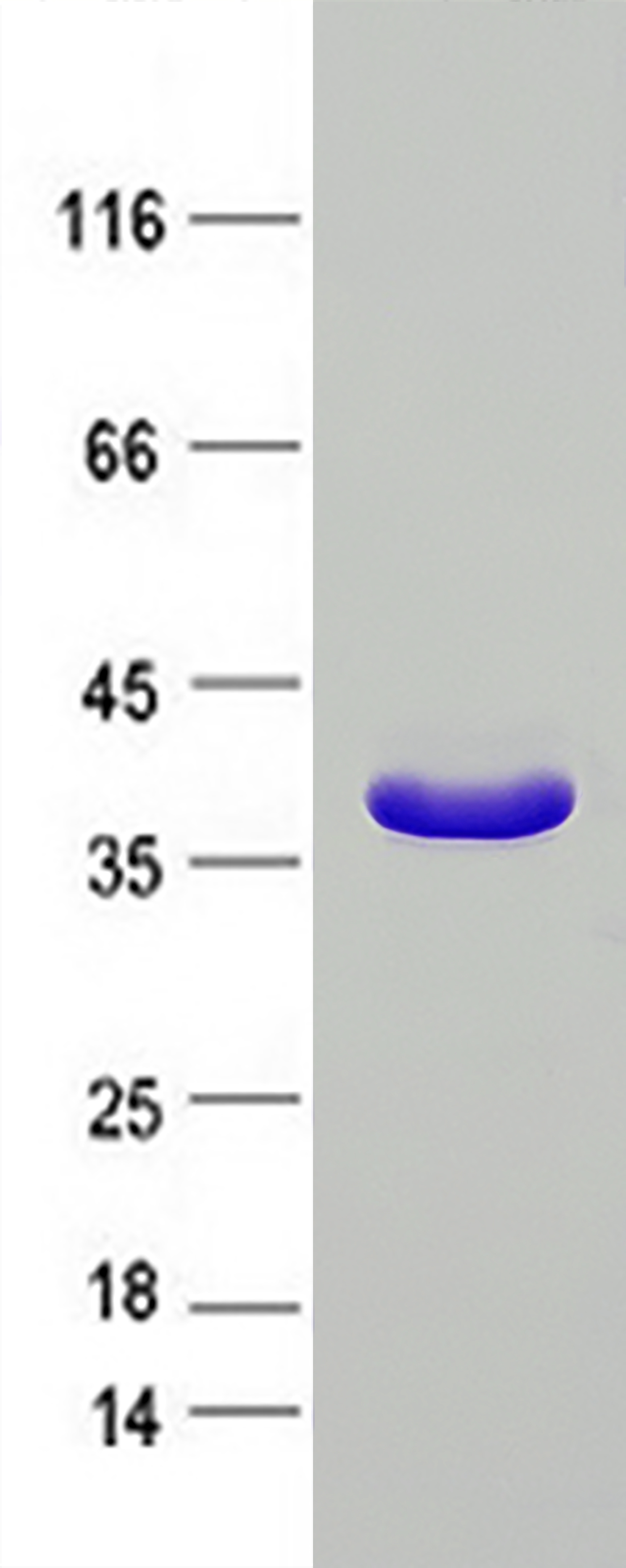 PECR (NM_018441) Human Recombinant Protein
