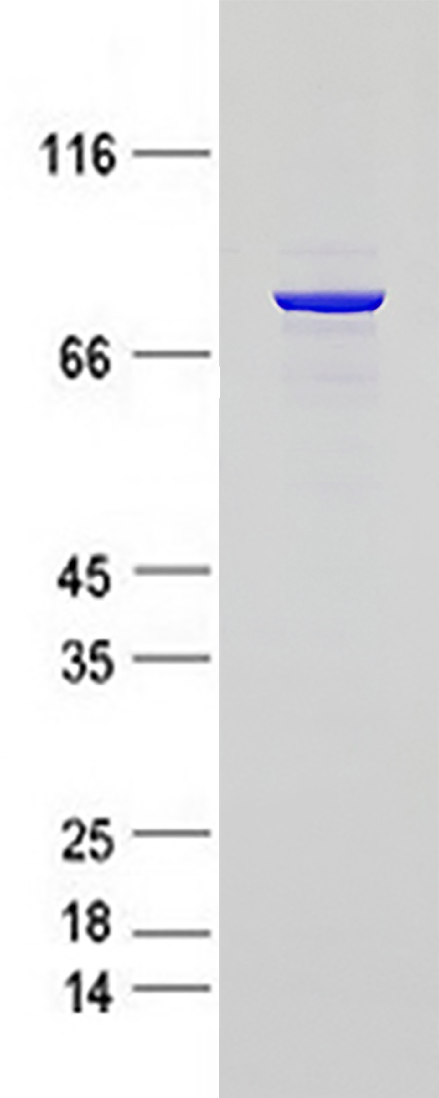 Cortactin (CTTN) (NM_138565) Human Recombinant Protein