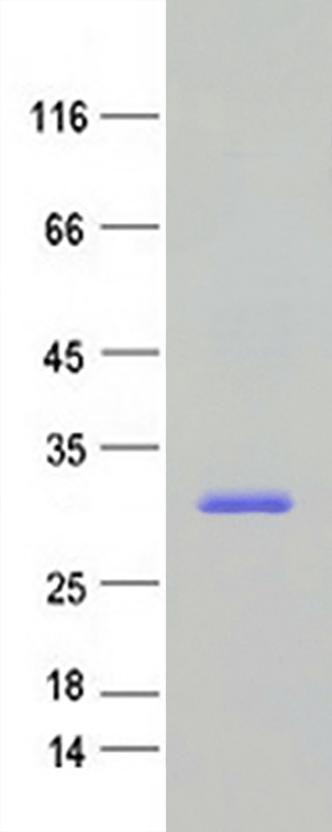 RAB10 (NM_016131) Human Recombinant Protein