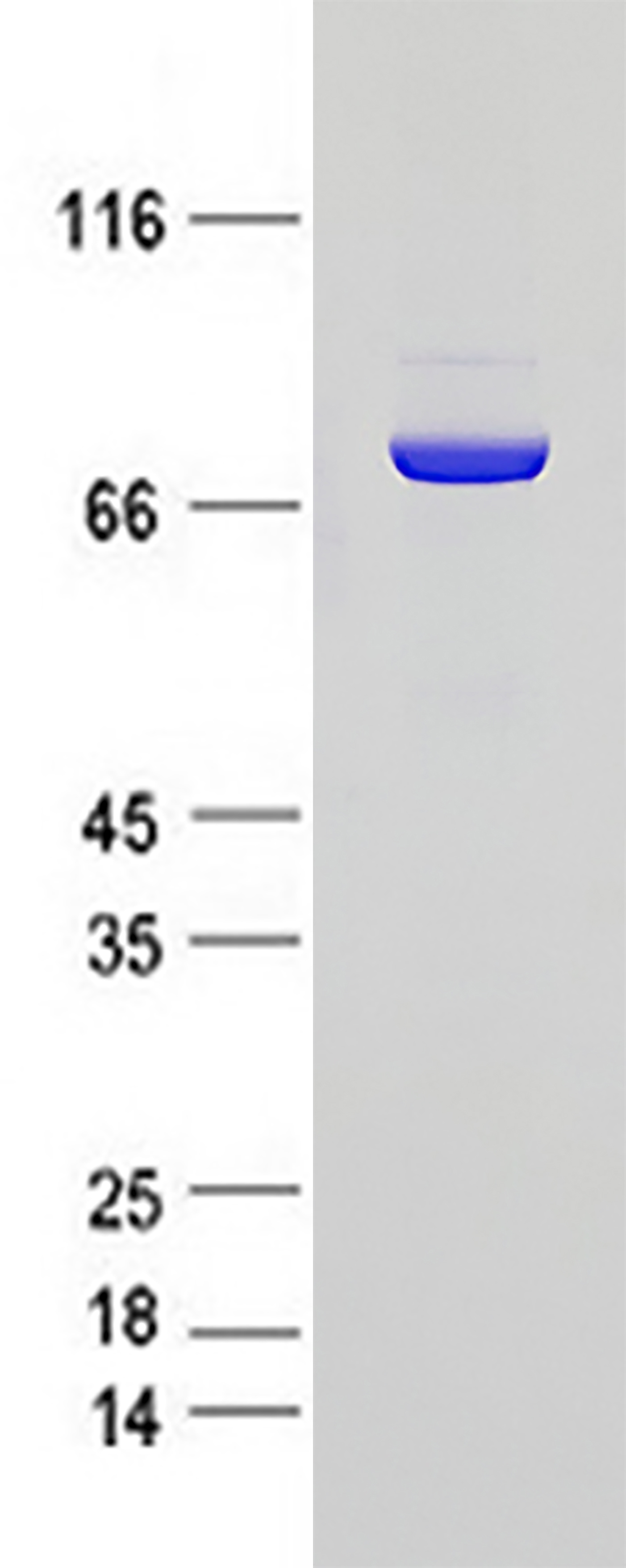 PKC zeta (PRKCZ) (NM_002744) Human Recombinant Protein