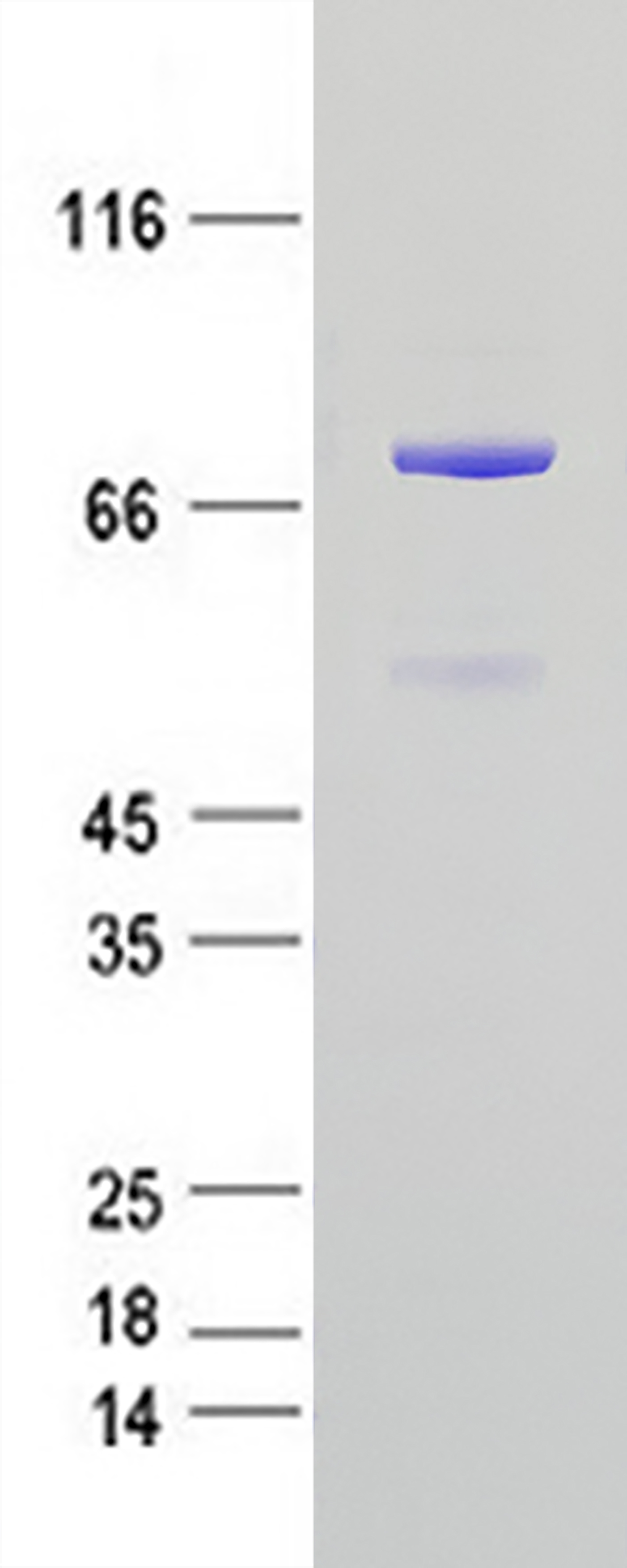 p60 CAF1 (CHAF1B) (NM_005441) Human Recombinant Protein