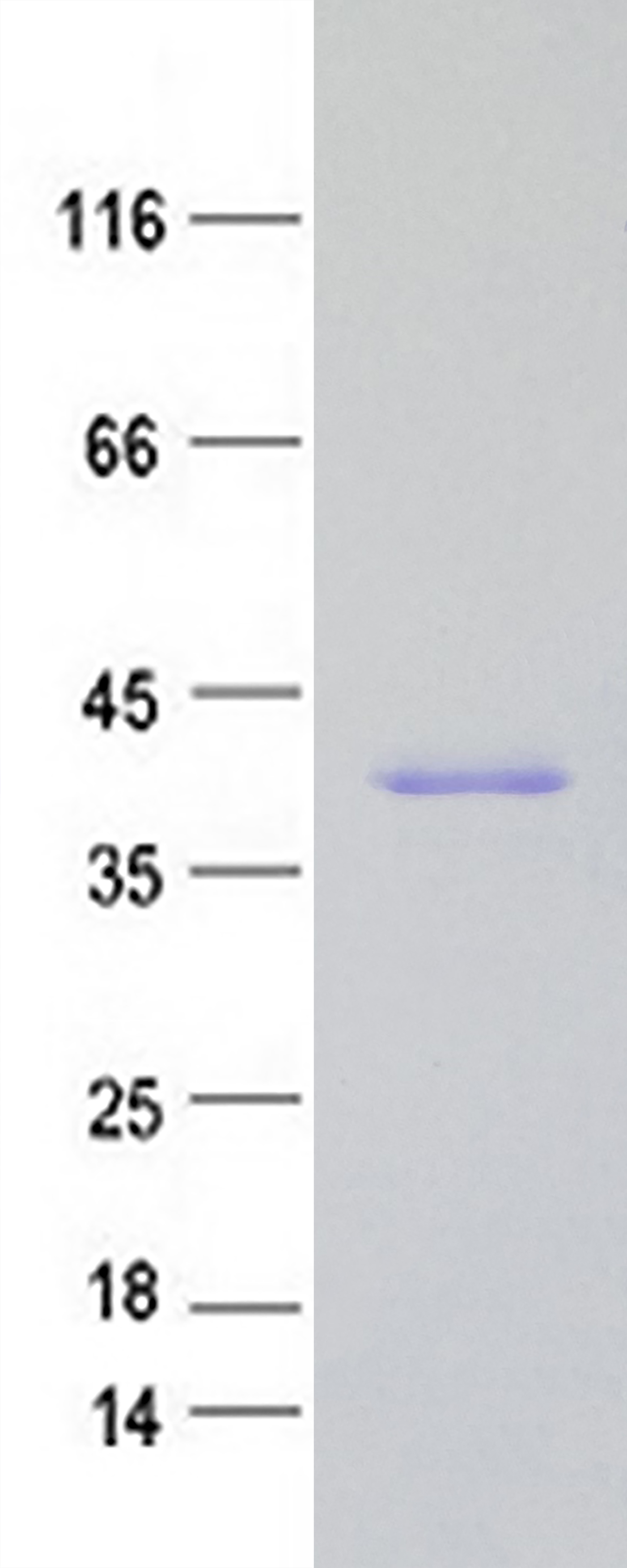 hnRNP A1 (HNRNPA1) (NM_002136) Human Recombinant Protein