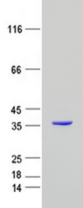 MTAP (NM_002451) Human Recombinant Protein