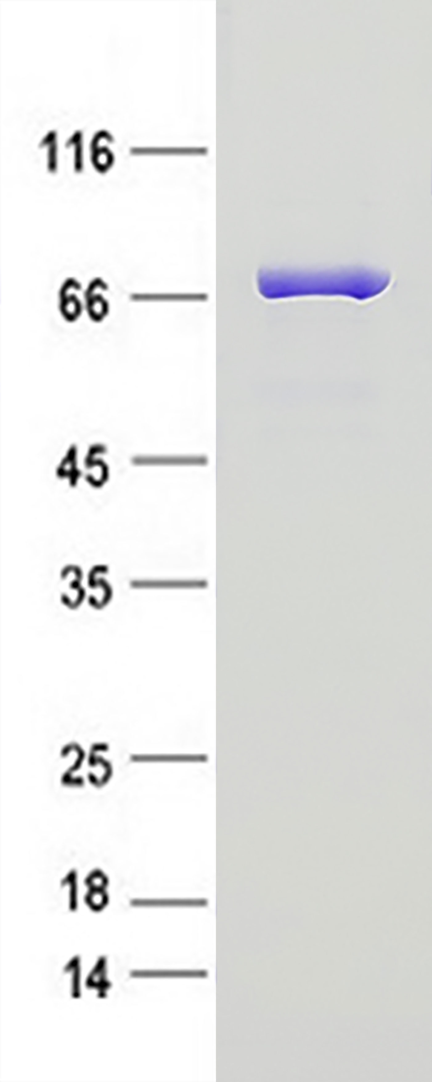 MTMR6 (NM_004685) Human Recombinant Protein