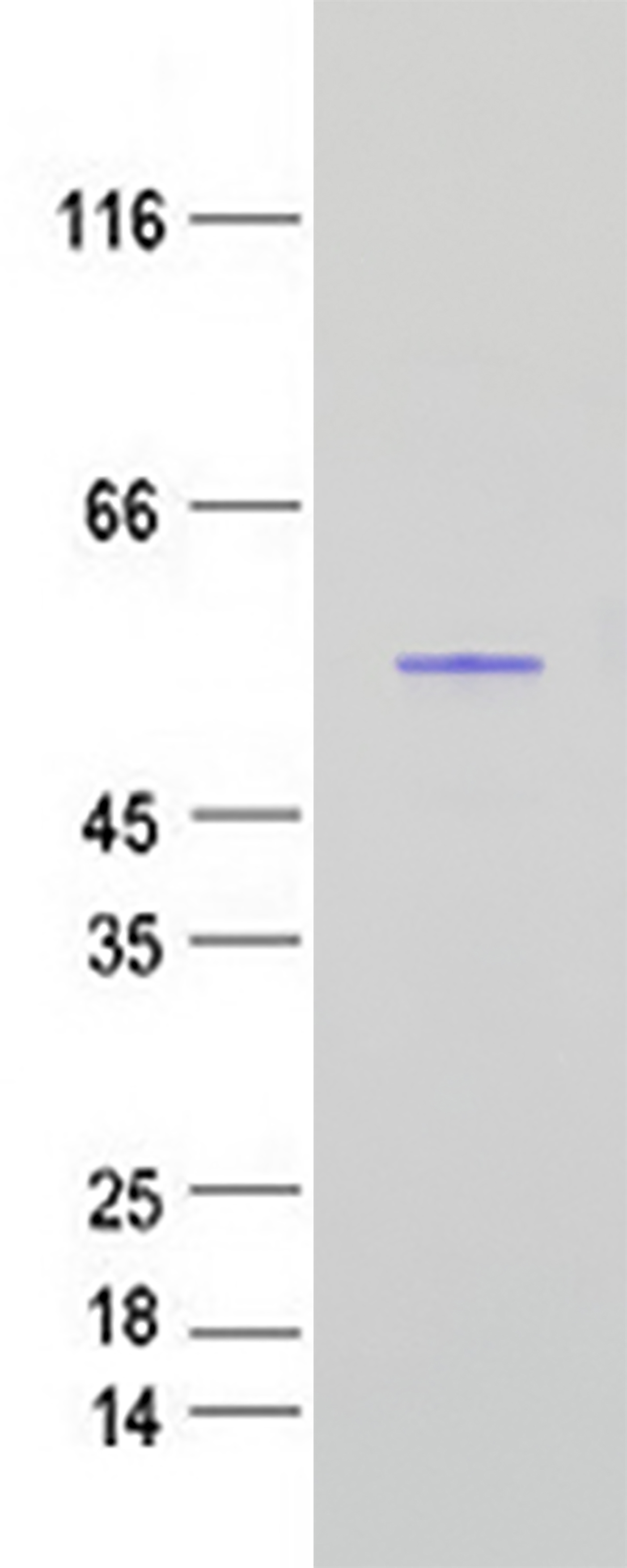 Aspartate beta hydroxylase (ASPH) (NM_032466) Human Recombinant Protein