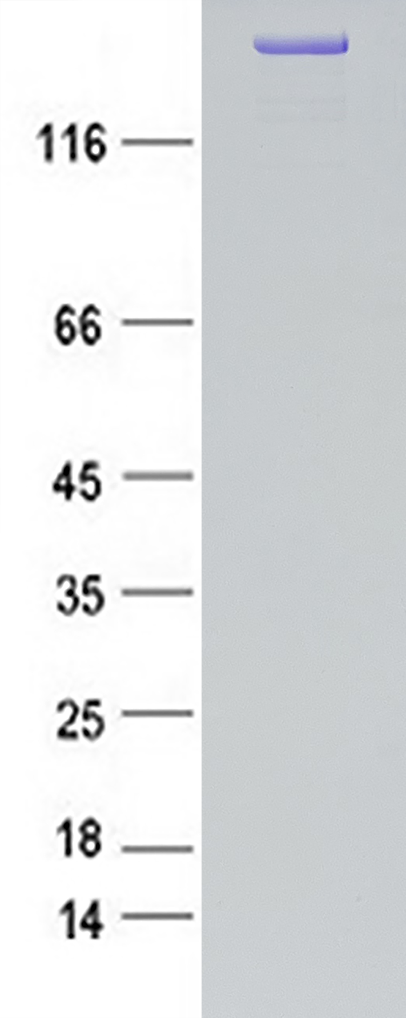 Collagen VII (COL7A1) (NM_000094) Human Recombinant Protein