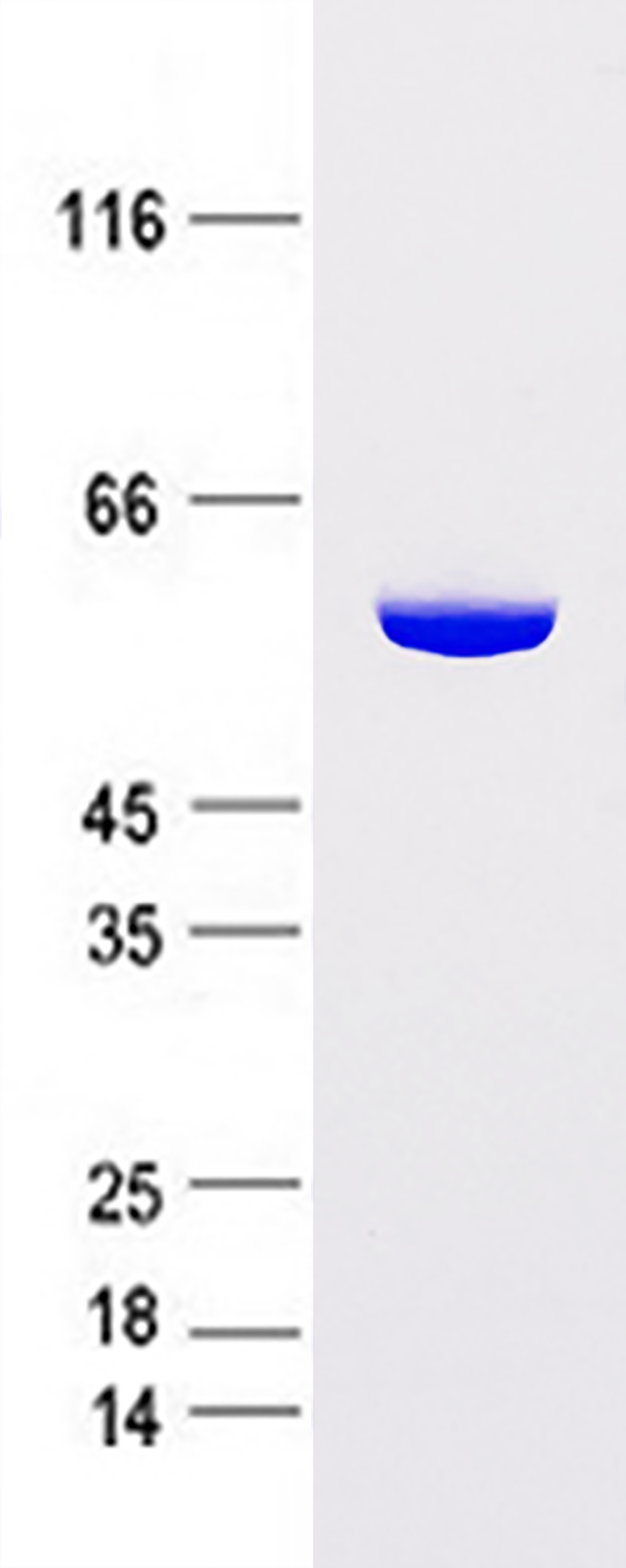 Coomassie blue staining of purified ALDH1A1 protein (Cat # TP300723). The protein was produced from HEK293 cells transfected with ALDH1A1 (Cat # <a href = "https://www.origene.com/catalog/cdna-clones/expression-plasmids/rc200723-aldh1a1-nm-000689-human-tagged-orf-clone" title="RC200723" class="">RC200723</a>).
