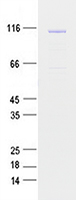 Coomassie blue staining of purified USP10 protein (Cat #TP300835). The protein was produced from mammalian cells transfected with USP10 cDNA clone (Cat #<a href = "https://www.origene.com/catalog/cdna-clones/expression-plasmids/rc200835-usp10-nm-005153-human-tagged-orf-clone" title="RC200835" class="">RC200835</a>).
