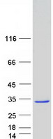 Coomassie blue staining of purified WDYHV1 protein (Cat# TP301055). The protein was produced from HEK293T cells transfected with WDYHV1 cDNA clone (Cat# RC201055) using MegaTran 2.0 (Cat# TT210002). Coomassie blue staining of purified WDYHV1 protein (Cat# TP301055). The protein was produced from HEK293T cells transfected with WDYHV1 cDNA clone (Cat# RC201055) using MegaTran 2.0 (Cat# TT210002).