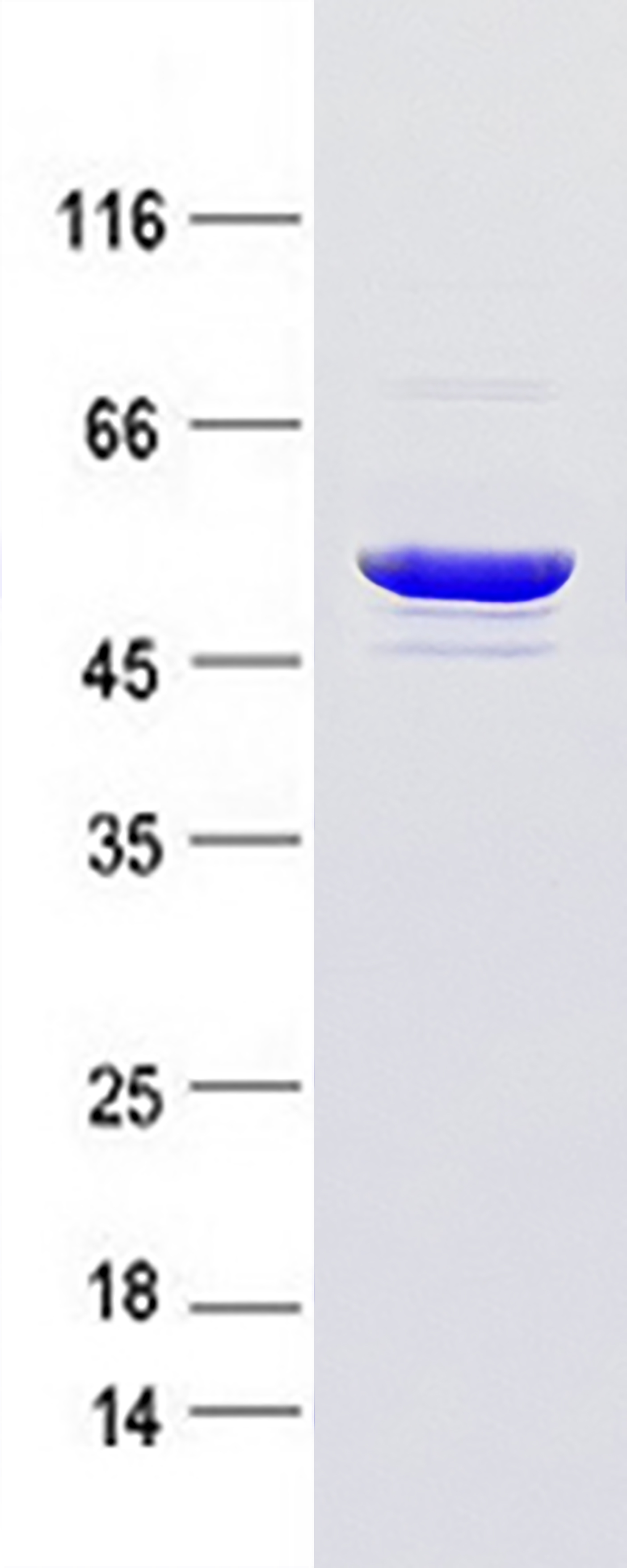 GFAP (NM_002055) Human Recombinant Protein