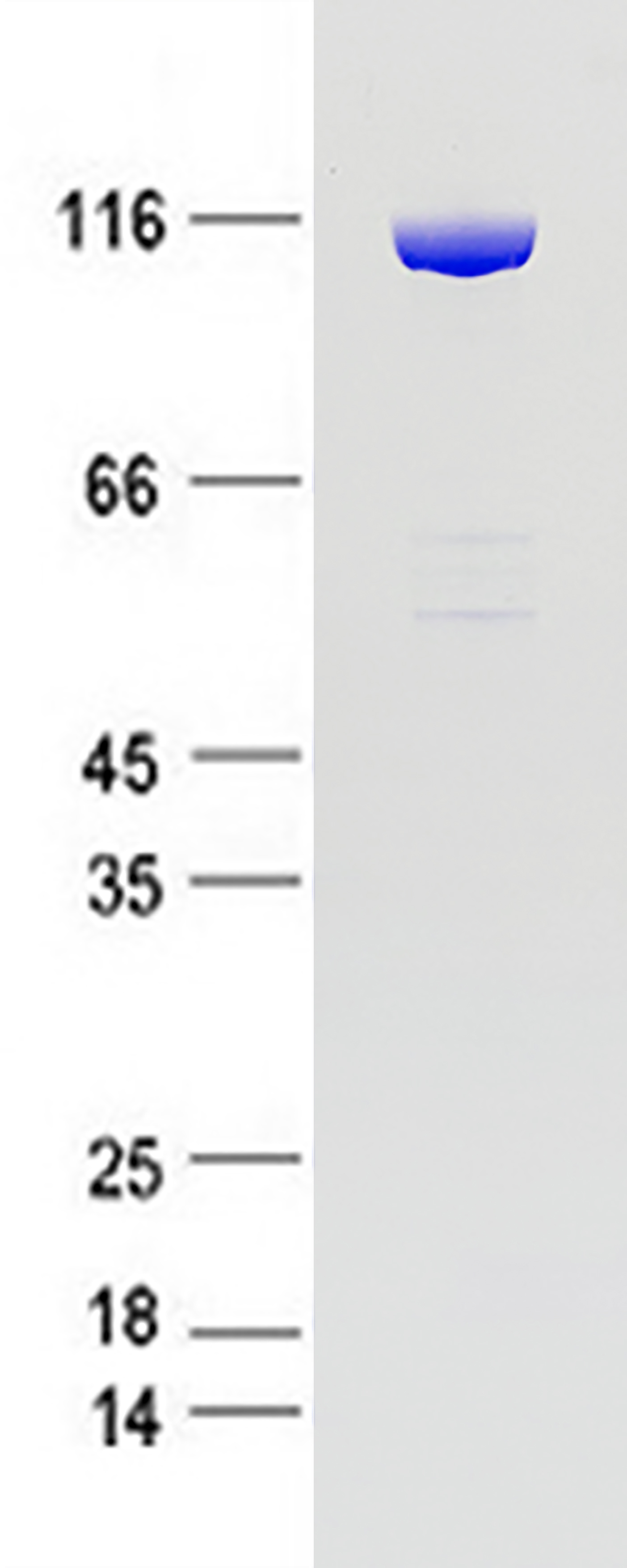 Coomassie blue staining of purified MSH2 protein (Cat # TP305848). The protein was produced from HEK293 cells transfected with MSH2 (Cat # <a href = "https://www.origene.com/catalog/cdna-clones/expression-plasmids/rc205848-msh2-nm-000251-human-tagged-orf-clone" title="RC205848" class="">RC205848</a>).