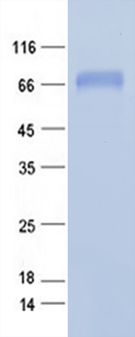 Coomassie blue staining of purified FGL2 protein (Cat #TP307557SE). The protein was produced from mammalian cells transfected with FGL2 cDNA clone (Cat #<a href = "https://www.origene.com/catalog/cdna-clones/expression-plasmids/rc207557-fgl2-nm-006682-human-tagged-orf-clone" title="RC207557" class="">RC207557</a>).