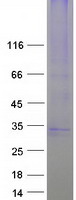 S1PR2 (NM_004230) Human Recombinant Protein