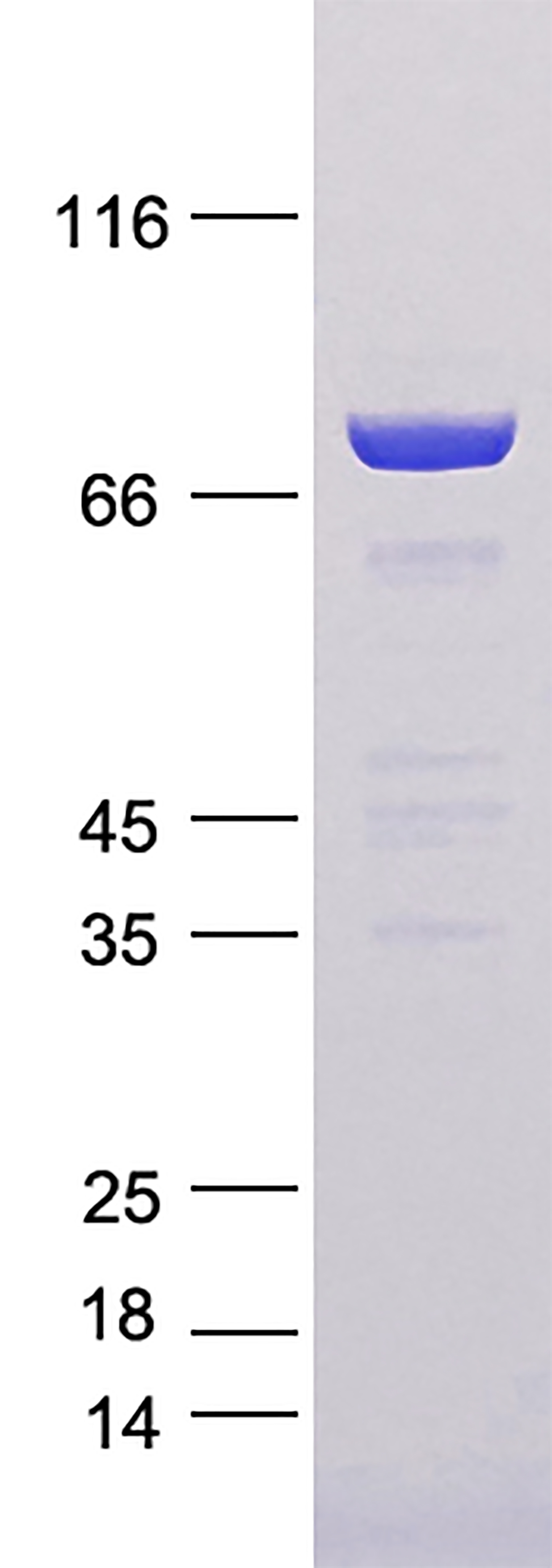 GGA1 (NM_013365) Human Recombinant Protein