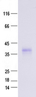 Coomassie blue staining of purified ORM2 protein (Cat #TP323213SE). The protein was produced from mammalian cells transfected with ORM2 cDNA clone (Cat #<a href = "https://www.origene.com/catalog/cdna-clones/expression-plasmids/rc223213-orosomucoid-2-orm2-nm-000608-human-tagged-orf-clone" title="RC223213" class="">RC223213</a>).