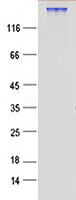 Coomassie blue staining of purified CHD4 protein (Cat #TP324232). The protein was produced from mammalian cells transfected with CHD4 cDNA clone (Cat #<a href = "https://www.origene.com/catalog/cdna-clones/expression-plasmids/rc224232-chd4-nm-001273-human-tagged-orf-clone" title="RC224232" class="">RC224232</a>).