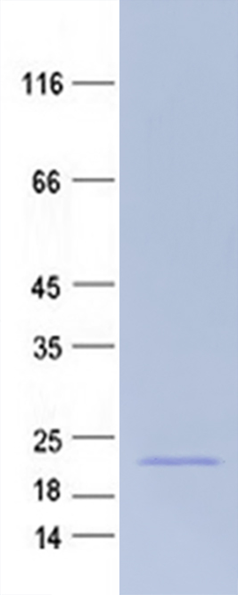 Coomassie blue staining of purified Rnase4 protein (Cat #TP501018SE). The protein was produced from mammalian cells transfected with Rnase4 cDNA clone (Cat #<a href = "https://www.origene.com/catalog/cdna-clones/expression-plasmids/mr201018-rnase4-nm-201239-mouse-tagged-orf-clone" title="MR201018" class="">MR201018</a>).