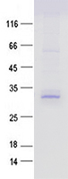 Mettl7a1 (NM_027334) Mouse Recombinant Protein