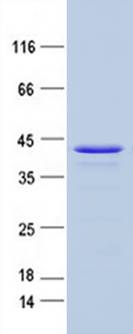 Coomassie blue staining of purified Igfbp1 protein (Cat #TP503644SE). The protein was produced from mammalian cells transfected with Igfbp1 cDNA clone (Cat #<a href = "https://www.origene.com/catalog/cdna-clones/expression-plasmids/mr203644-igfbp1-nm-008341-mouse-tagged-orf-clone" title="MR203644" class="">MR203644</a>).