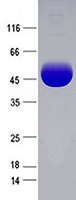 Western blot image of TP701435.