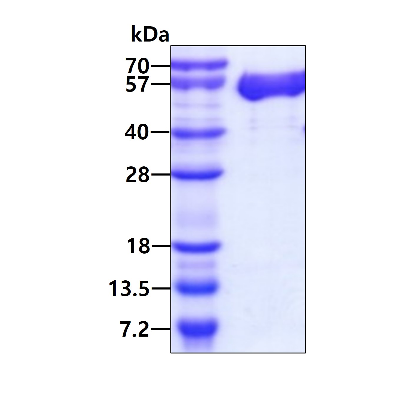 EFNA5 (21203, hIgGHisTag) Human Protein