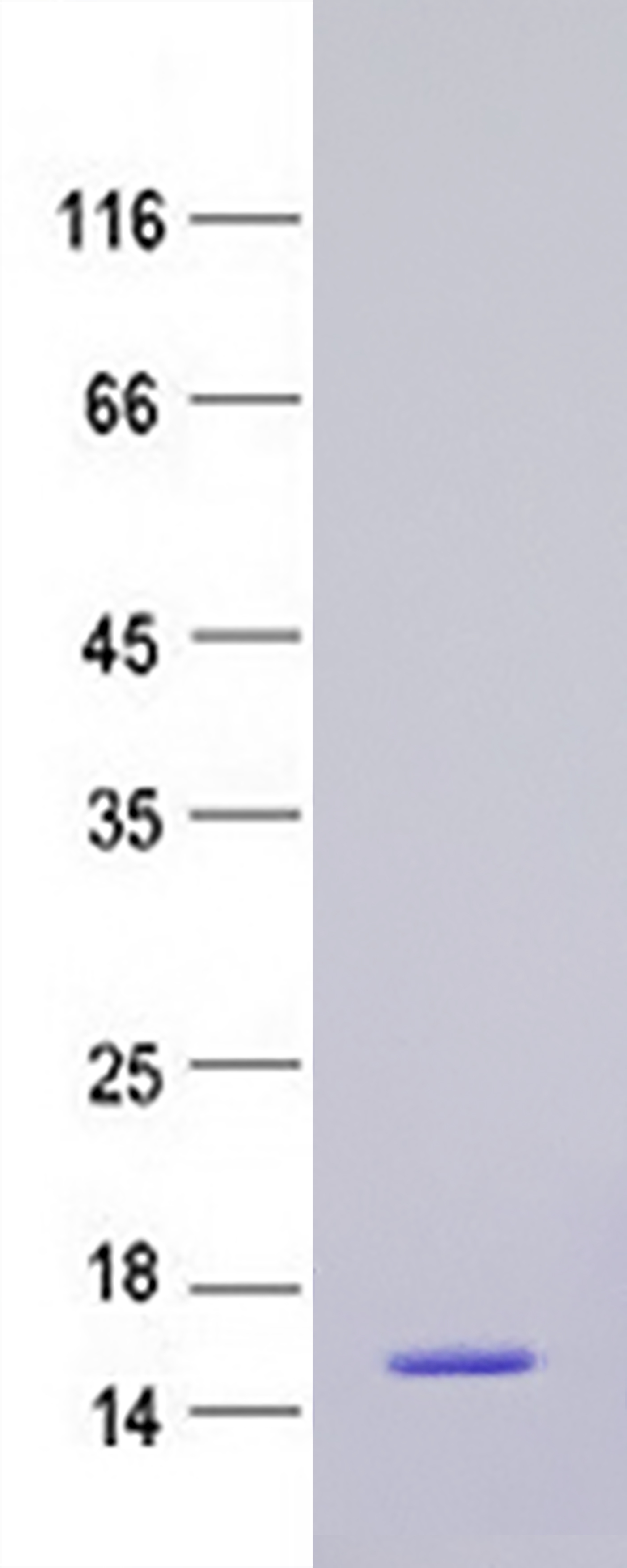 GM CSF (CSF2) (NM_000758) Human Recombinant Protein