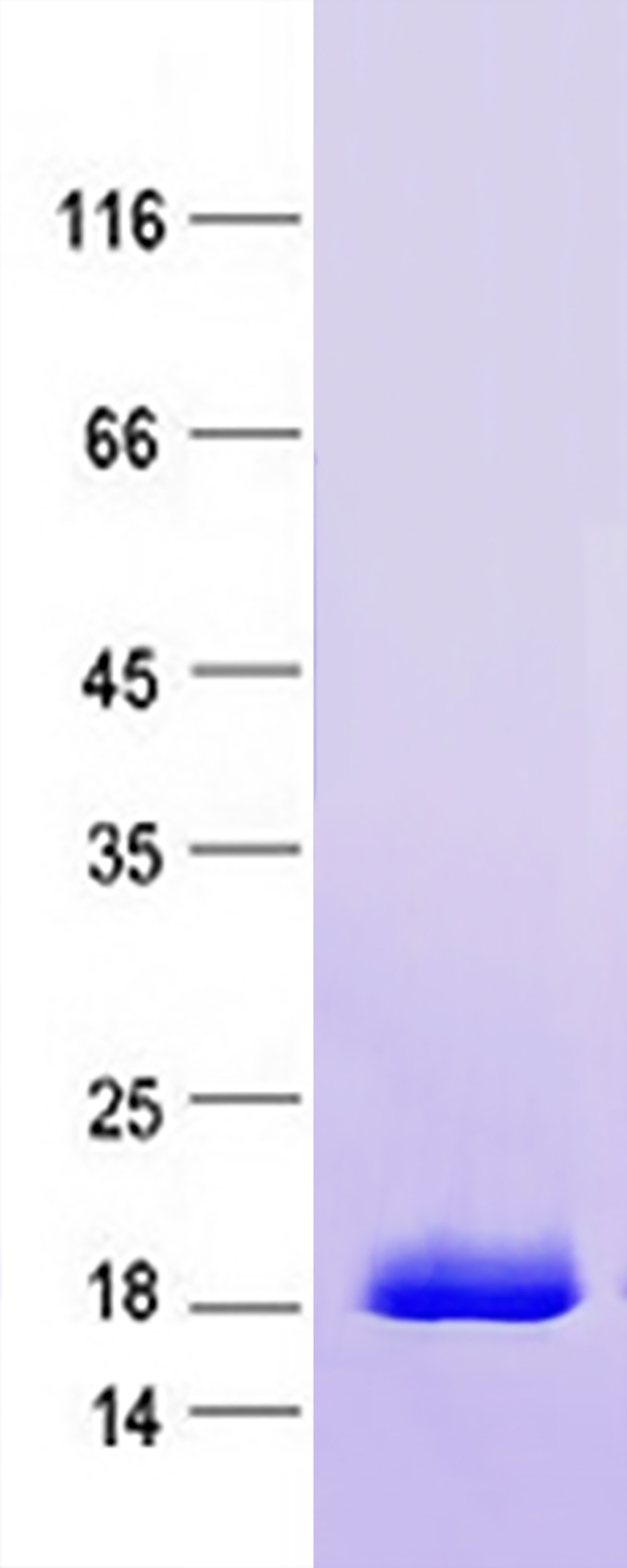 FGF2 (NM_001361665) Human Recombinant Protein