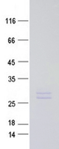 Coomassie blue staining of purified FGF5 protein (Cat #TP750284). The protein was produced from E.coli.