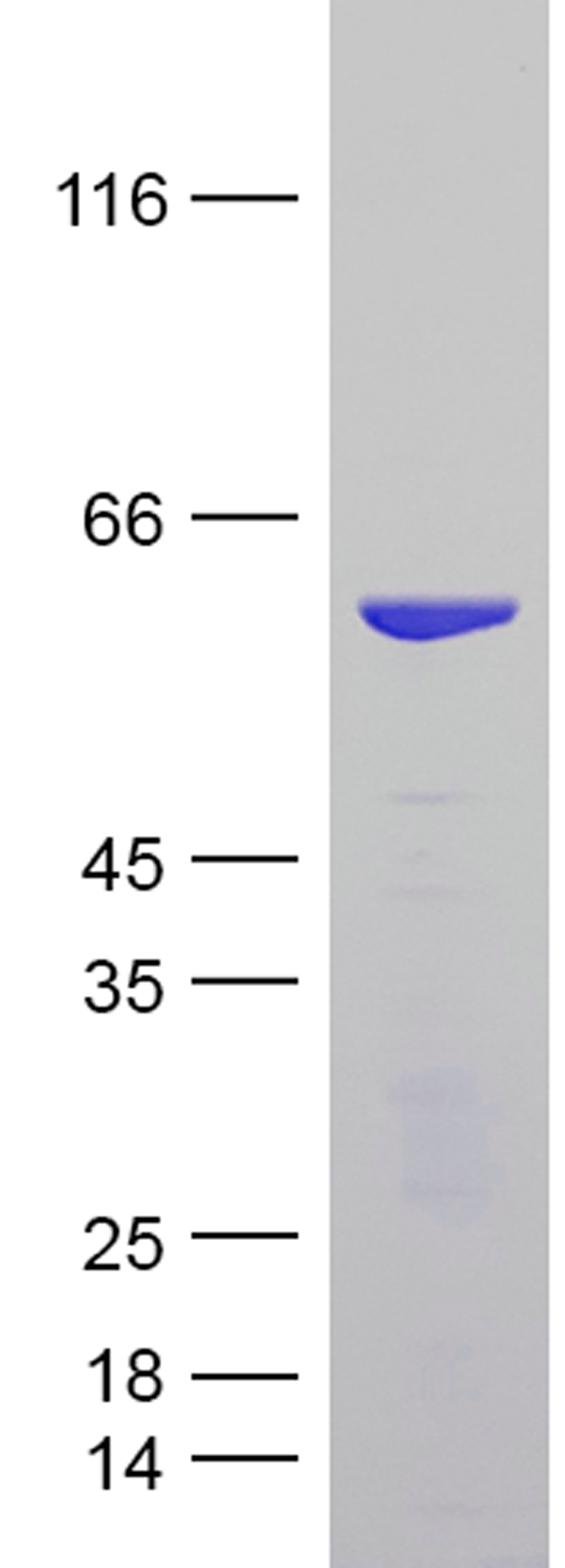 Coomassie blue staining of purified Tau-441 (2N4R) protein (Cat #TP750289). The protein was produced from E.coli.
