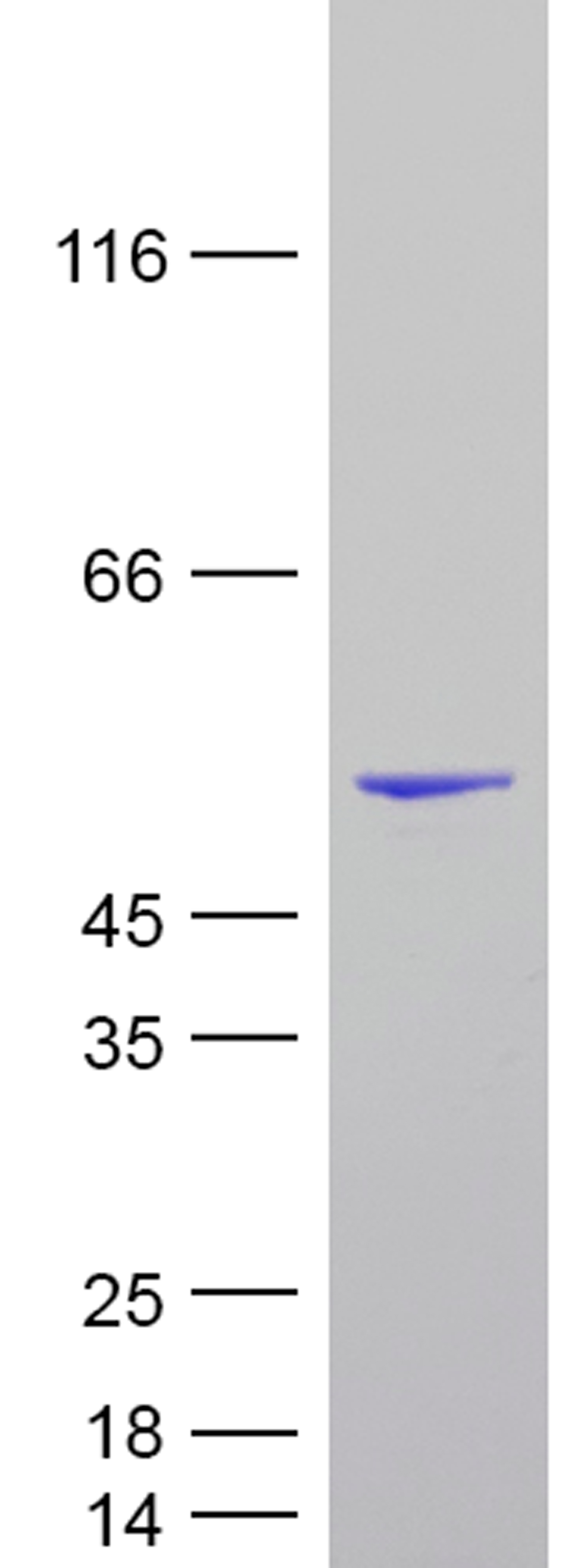 Coomassie blue staining of purified Tau-410 (2N3R) protein (Cat #TP750313). The protein was produced from E.coli.