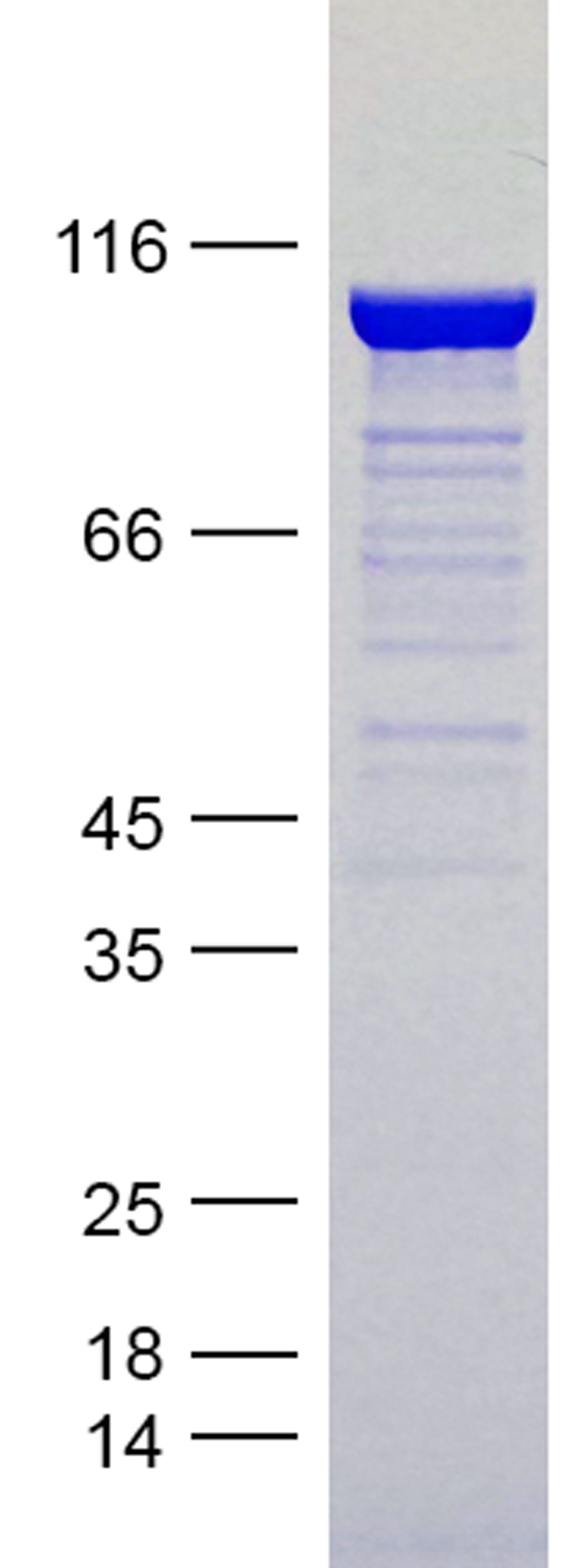 Coomassie blue staining of purified PNS-Tau protein (Cat #TP750316). The protein was produced from E.coli.