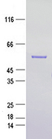Coomassie blue staining of purified REST protein (Cat #TP762777). The protein was produced from E.coli.