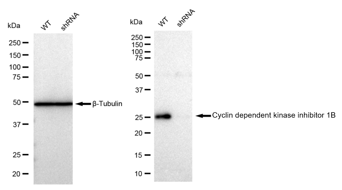 Western blotting analysis. CDKN1B protein expression in wild-type (WT) and shRNA knockdown (KD) HSHC cells was detected using Western blotting. β-Tubulin served as a loading control. The blots were incubated with primary antibodies against CDKN1B and β-Tubulin, respectively, followed by incubating with HRP-conjugated goat anti-rabbit secondary antibody. Images were developed using FeQ™ ECL Substrate Kit (Cat#226).