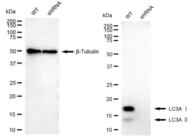 Western blotting analysis. MAP1LC3A protein expression in wild-type (WT) and shRNA knockdown (KD) HeLa cells was detected using Western blotting. β-Tubulin served as a loading control. The blots were incubated with primary antibodies against MAP1LC3A and β-Tubulin, respectively, followed by incubating with HRP-conjugated goat anti-rabbit secondary antibody. Images were developed using FeQ™ ECL Substrate Kit (Cat#226).