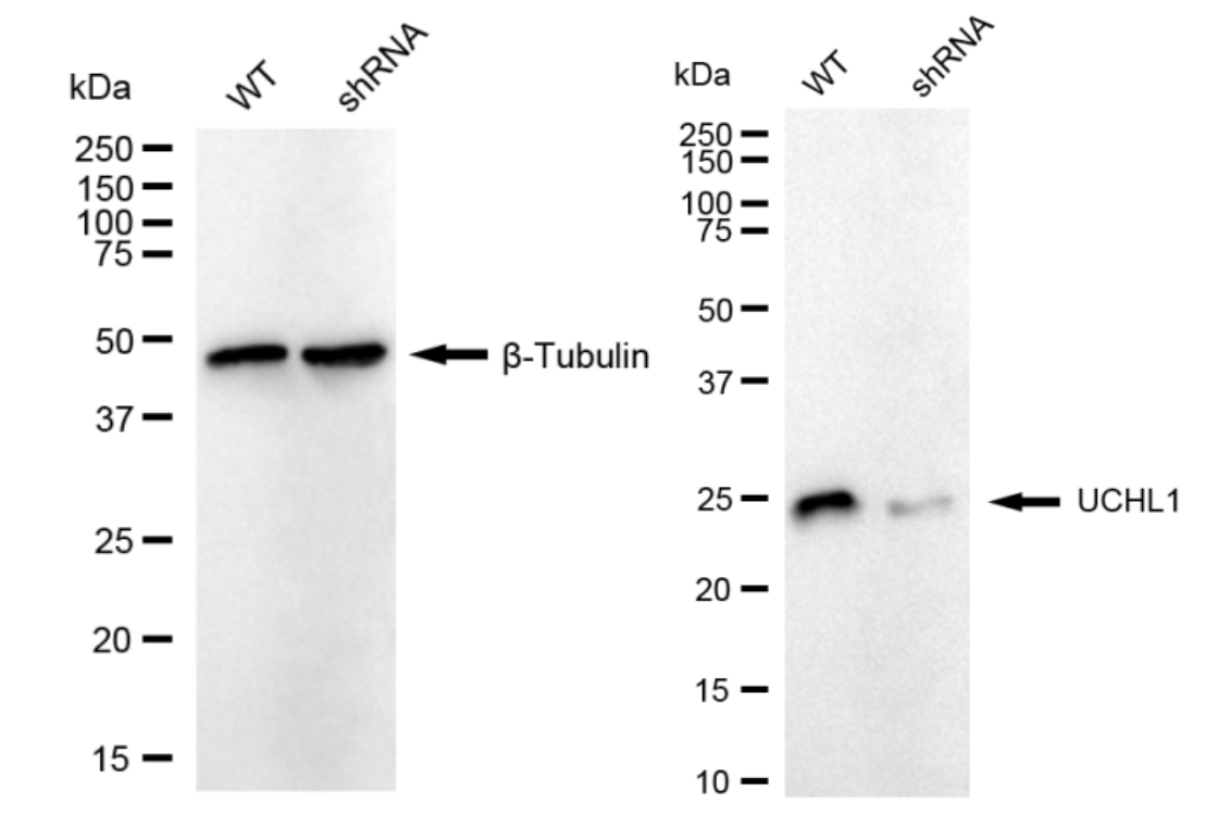 Western blotting analysis. UCHL1 protein expression in wild-type (WT) and shRNA knockdown (KD) HSHC cells was detected using Western blotting. β-Tubulin served as a loading control. The blots were incubated with primary antibodies against UCHL1 and β-Tubulin, respectively, followed by incubating with HRP-conjugated goat anti-rabbit secondary antibody. Images were developed using FeQ™ ECL Substrate Kit.
