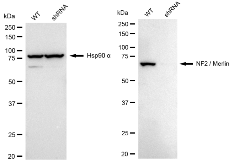 Western blotting analysis. NF2 protein expression in wild-type (WT) and shRNA knockdown (KD) HeLa cells was detected using Western blotting. Hsp90 α served as a loading control. The blots were incubated with primary antibodies against NF2 and Hsp90 α, respectively, followed by incubating with HRP-conjugated goat anti-rabbit secondary antibody. Images were developed using FeQ™ ECL Substrate Kit.
