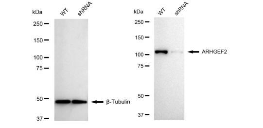 Western blotting analysis. ARHGEF2 protein expression in wild-type (WT) and shRNA knockdown (KD) HeLa cells was detected using Western blotting. β-Tubulin served as a loading control. The blots were incubated with primary antibodies against ARHGEF2 and β-Tubulin, respectively, followed by incubating with HRP-conjugated goat anti-rabbit secondary antibody. Images were developed using FeQ™ ECL Substrate Kit (Cat#226).