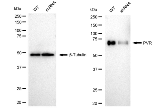 Western blotting analysis. PVR protein expression in wild-type (WT) and shRNA knockdown (KD) HeLa cells was detected using Western blotting. β-Tubulin served as a loading control. The blots were incubated with primary antibodies against PVR and β-Tubulin, respectively, followed by incubating with HRP-conjugated goat anti-rabbit secondary antibody. Images were developed using FeQ™ ECL Substrate Kit (Cat#226).