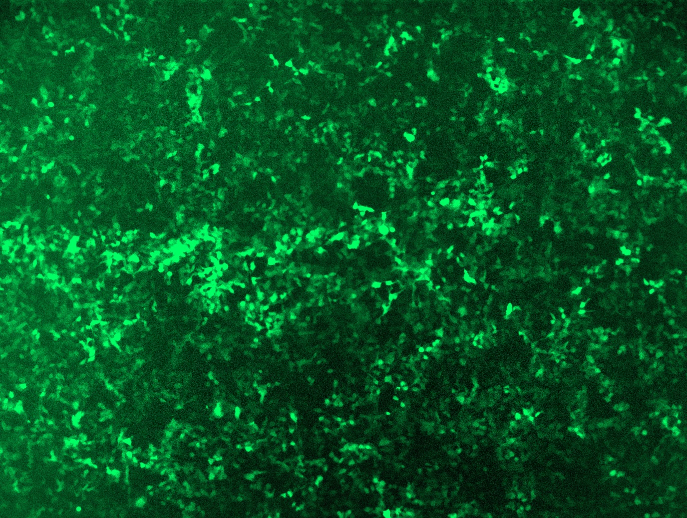GFP signal was observed under microscope at 48 hours after transduction of TL303354D virus into HEK293 cells. TL303354D virus was prepared using lenti-shRNA TL303354D and <a href = "https://www.origene.com/catalog/others/lentiviral-packaging-kits/tr30037-lentiviral-packaging-kits" title="TR30037" class="">TR30037</a> packaging kit.