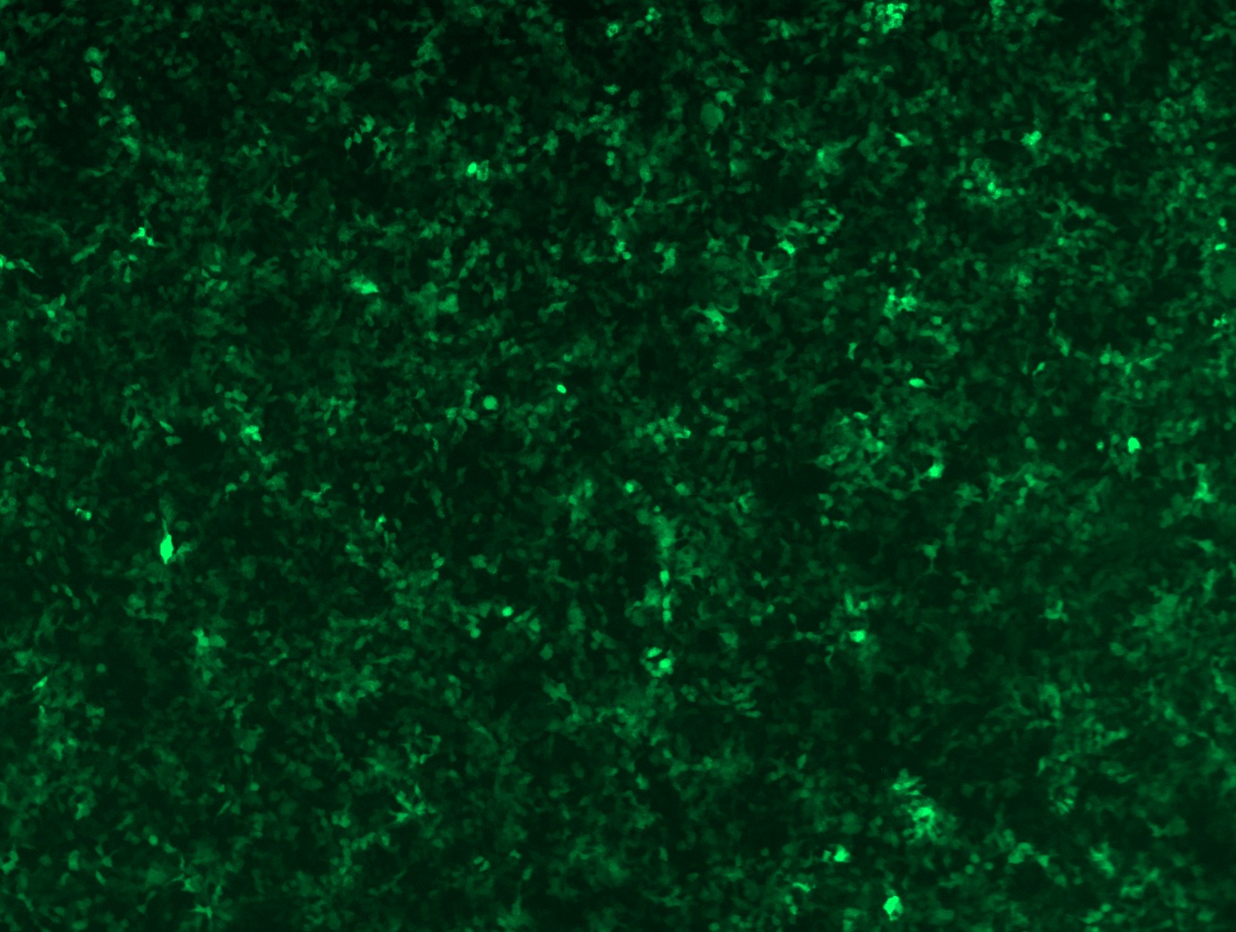 GFP signal was observed under microscope at 48 hours after transduction of TL305195A virus into HEK293 cells. TL305195A virus was prepared using lenti-shRNA TL305195A and <a href="https://www.origene.com/catalog/others/lentiviral-packaging-kits/tr30037-lentiviral-packaging-kits" title="TR30037" class="">TR30037</a> packaging kit.