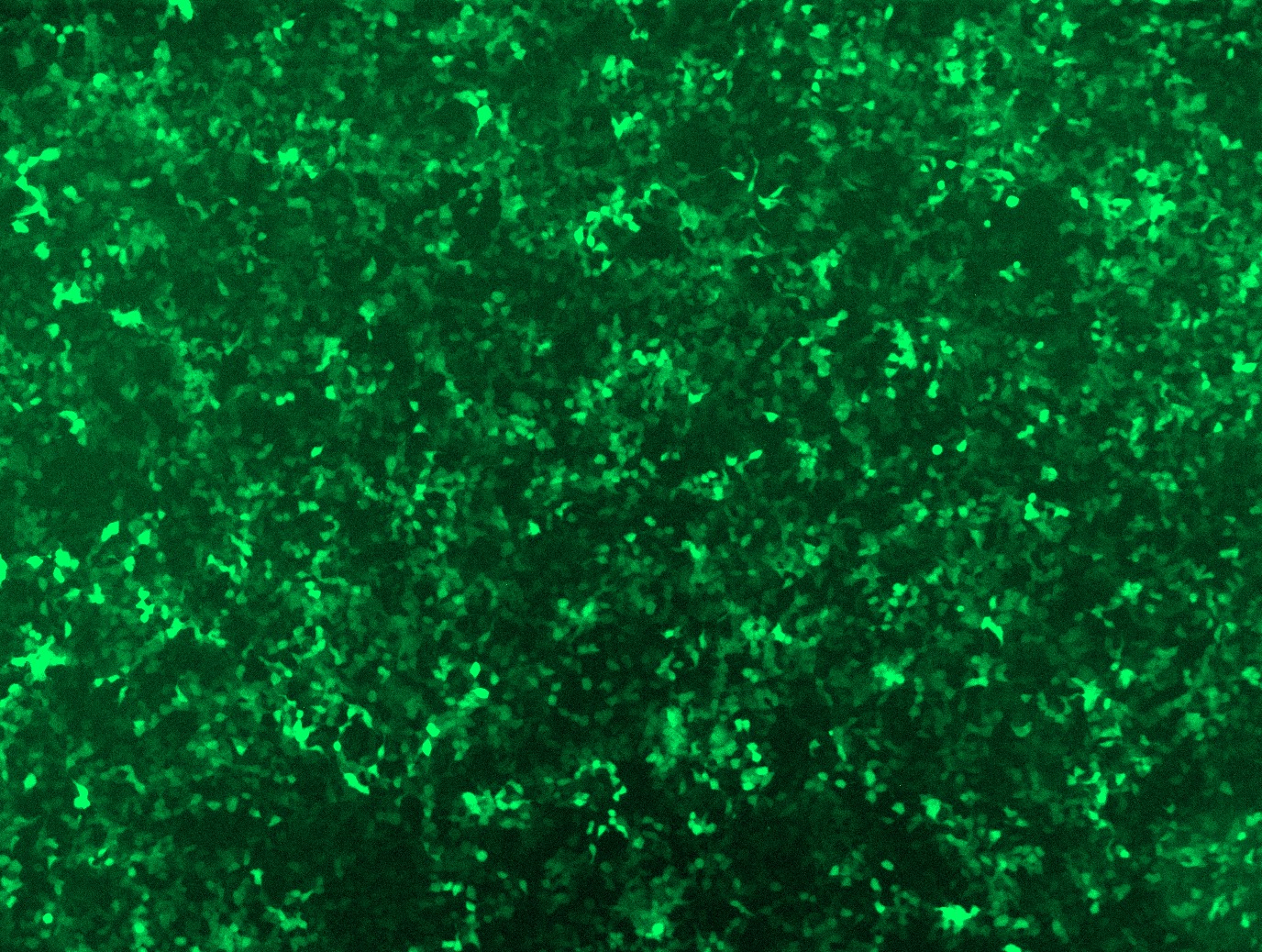 GFP signal was observed under microscope at 48 hours after transduction of TL314751B virus into HEK293 cells. TL314751B virus was prepared using lenti-shRNA TL314751B and <a href = "https://www.origene.com/catalog/others/lentiviral-packaging-kits/tr30037-lentiviral-packaging-kits" title="TR30037" class="">TR30037</a> packaging kit.