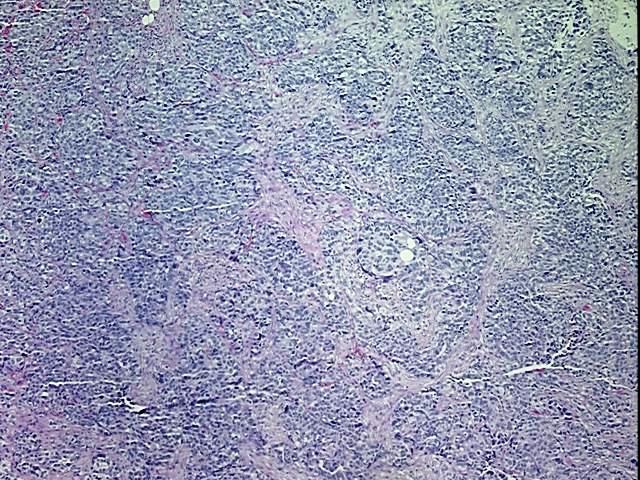 FFPE Tissue Blocks, Ovary | CB700496 | OriGene Technologies Inc.