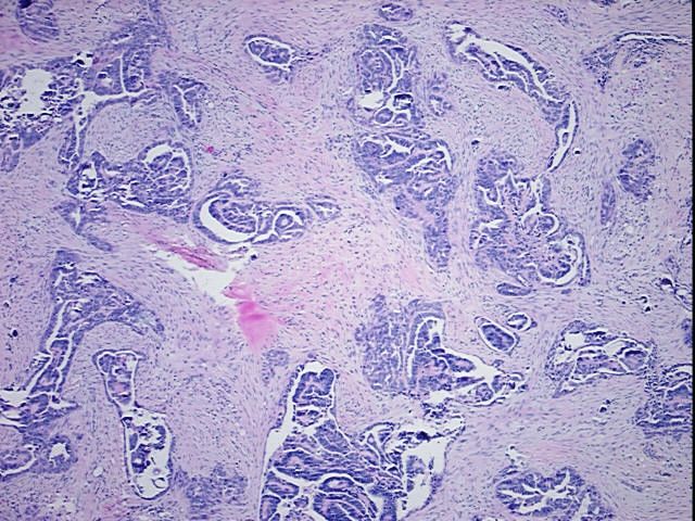 FFPE Tissue Blocks, Omentum | CB701130 | OriGene Technologies Inc.