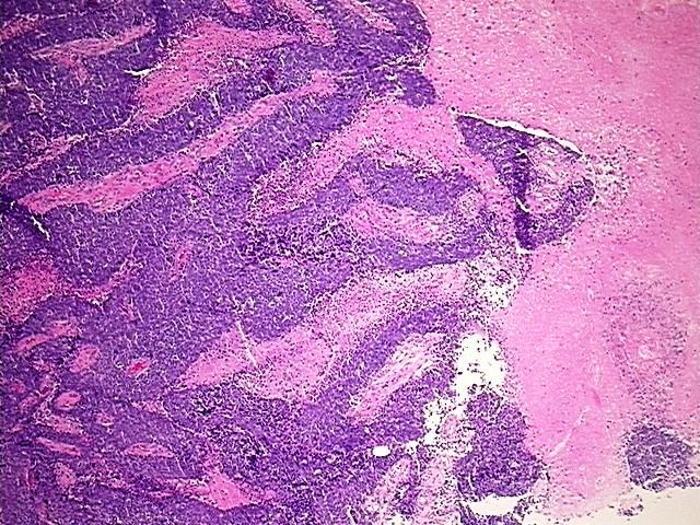 FFPE Tissue Blocks, Ovary: left | CB801389 | OriGene Technologies Inc.